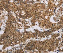 IL5RA Polyclonal Antibody - 3