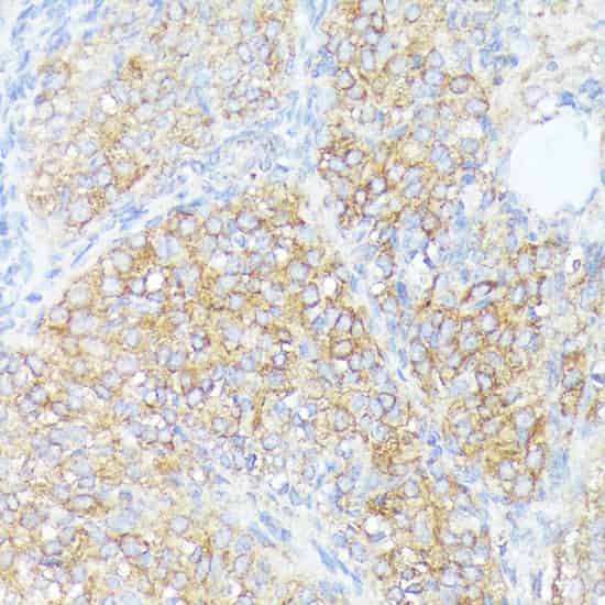 Immunohistochemistry of paraffin-embedded Rat ovary using SLC7A2 Polyclonal Antibody at dilution of 1:100 (40x lens).