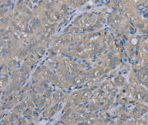 EZR Polyclonal Antibody - 2