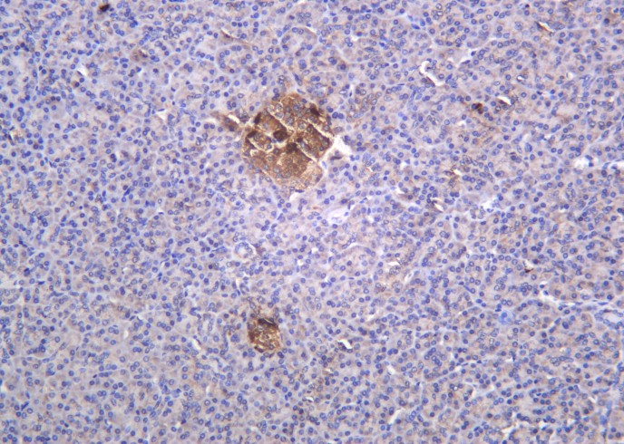 Recombinant Glucagon Monoclonal Antibody-searchlist-1