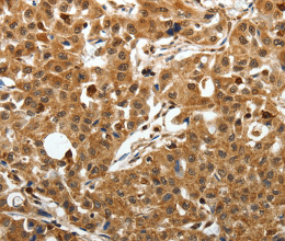 SOX-13 Polyclonal Antibody - 3