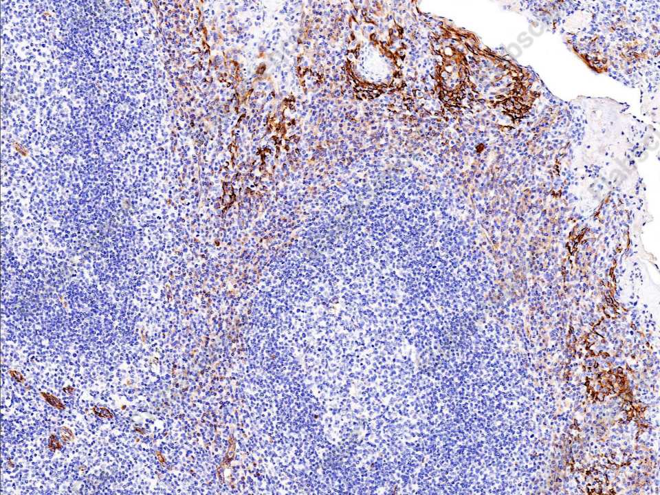 Recombinant SPARCL1/SPARC-like 1 Monoclonal Antibody - 1