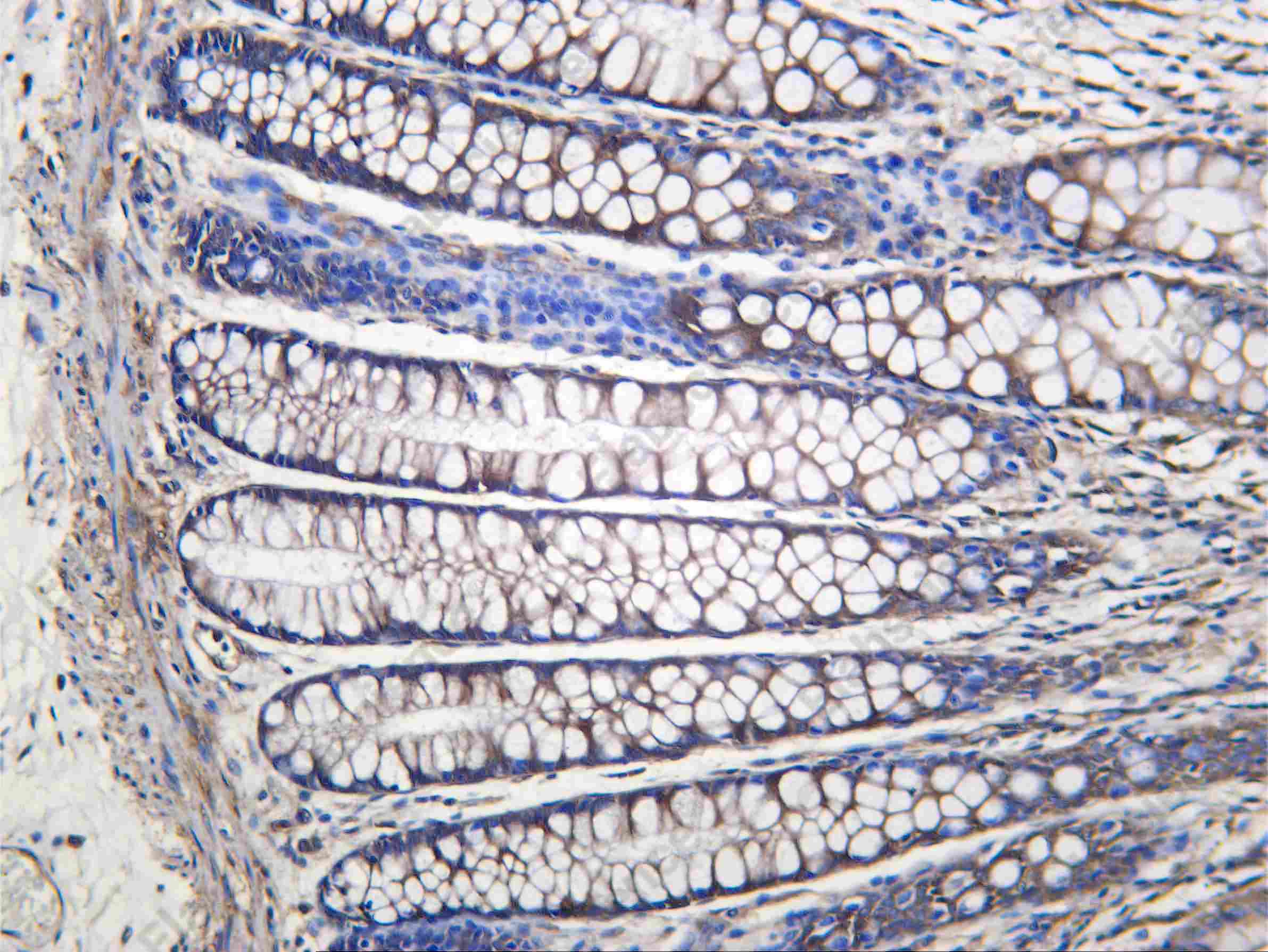 Recombinant Arrestin-β-1 Monoclonal Antibody - 1