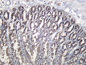Recombinant EFP Monoclonal Antibody - 3