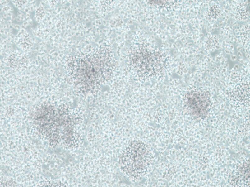 CCRF-SB Cell Complete Medium - 2