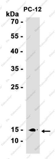 Recombinant Histone H2A.X Monoclonal Antibody - 2