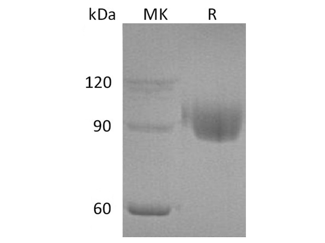 Recombinant Human PIGR Protein (His Tag)