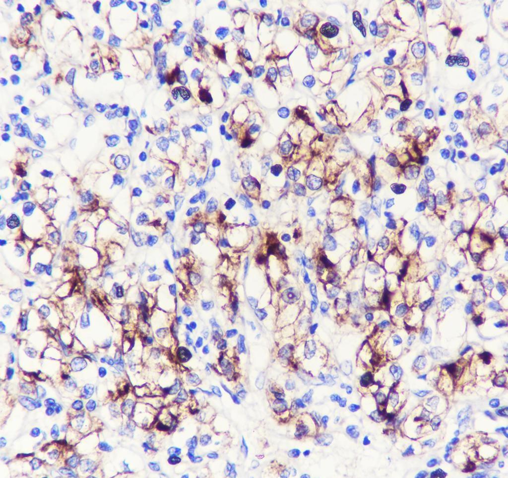 Recombinant ACE2 Monoclonal Antibody - 3