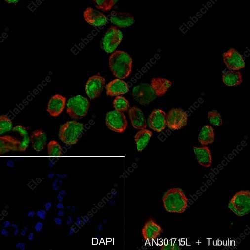 Recombinant ERG Monoclonal Antibody - 6