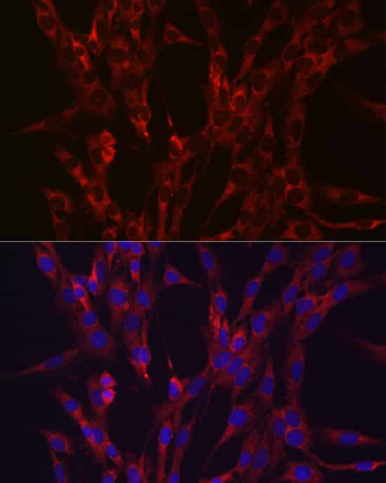 Immunofluorescence analysis of C6 cells using HIF3A Polyclonal Antibody at dilution of 1:100 (40x lens). Blue: DAPI for nuclear staining.