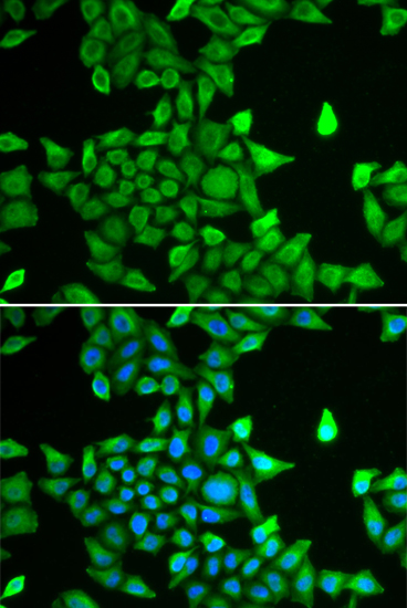 Immunofluorescence analysis of MCF-7 cells using PSMA6 Polyclonal Antibody Blue: DAPI for nuclear staining.