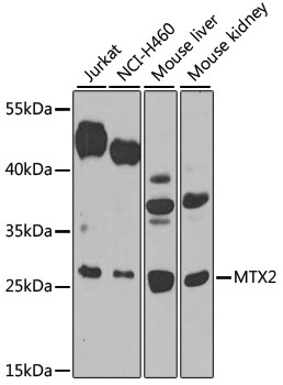 Western blot analysis of extracts of various cell lines using MTX2 Polyclonal Antibody at 1:1000 dilution.