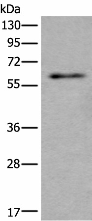 Western blot analysis of Mouse testis tissue lysate  using SCP2 Polyclonal Antibody at dilution of 1:350