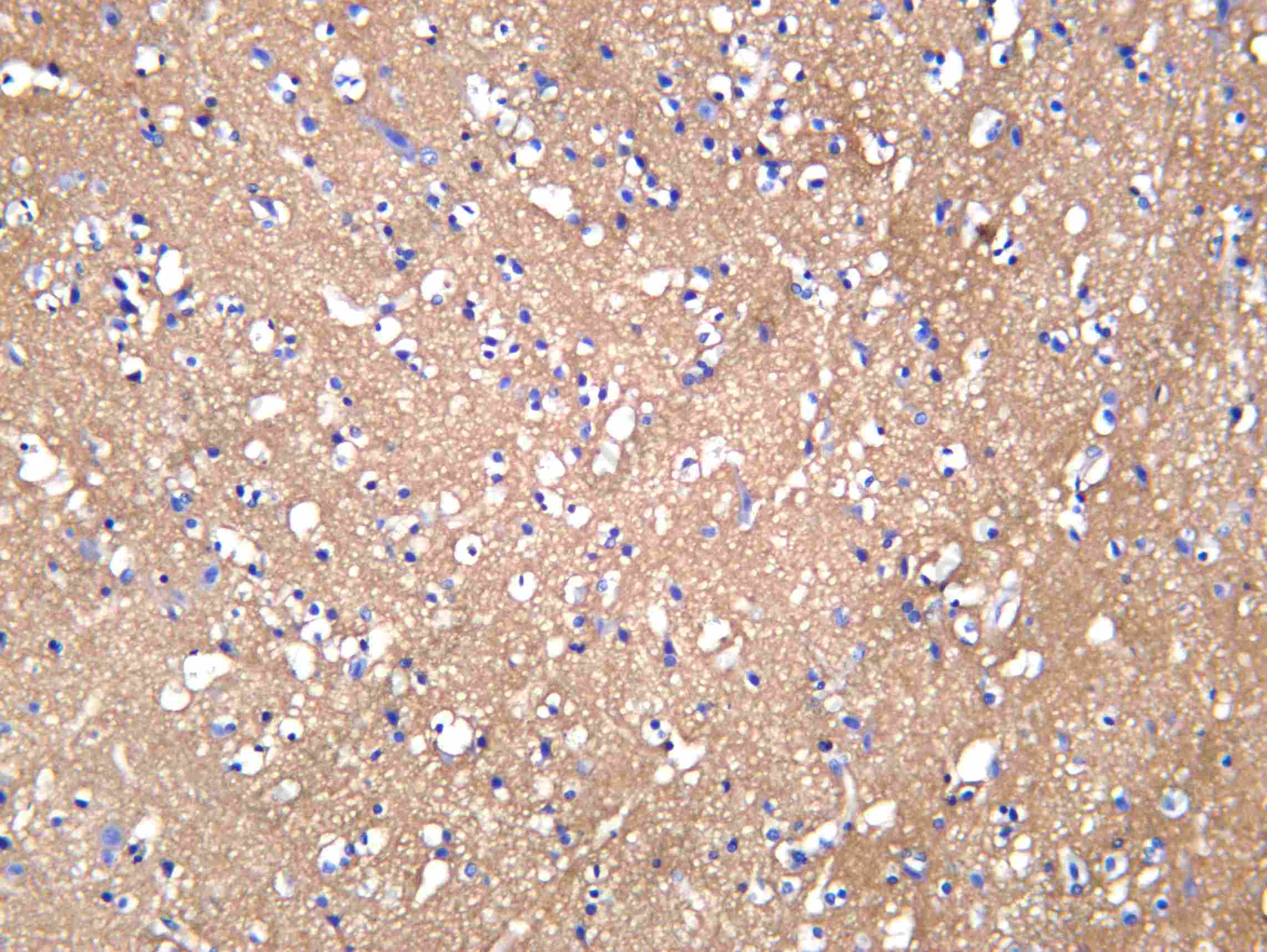 Recombinant mGluR2 Monoclonal Antibody - 1