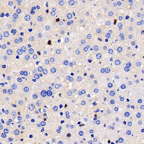 Immunohistochemistry analysis of paraffin-embedded mouse inflammatory liver  using MMP9 Monoclonal Antibody at dilution of 1:400.