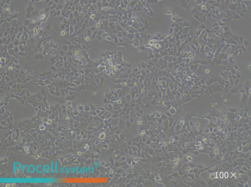 NCI-H322 Cell Complete Medium - 1