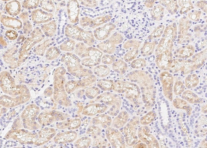 ENTPD5 Monoclonal Antibody - 2