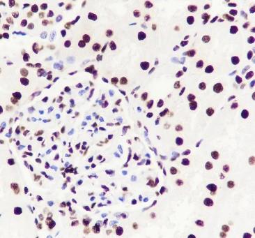 Recombinant ILF3 Monoclonal Antibody - 2