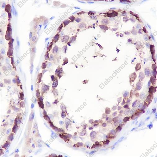 Recombinant STIP1/STI1 Monoclonal Antibody - 2