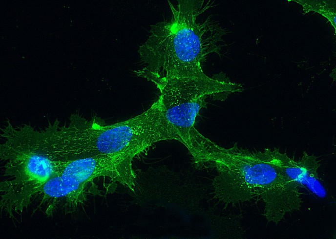 Recombinant E-Selectin/CD62e/SELE Monoclonal Antibody-searchlist-1