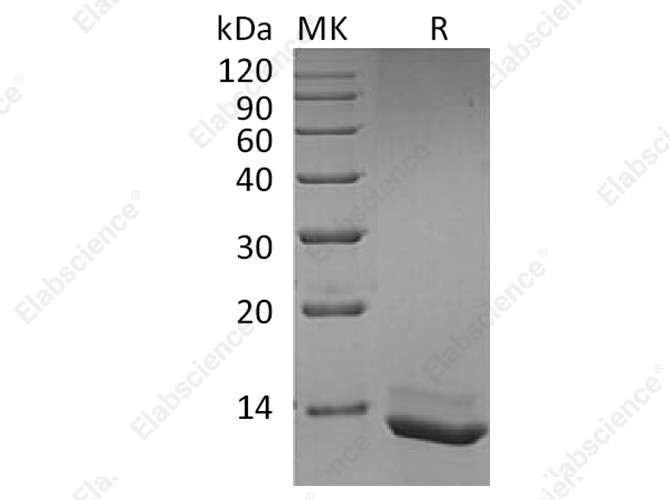 Recombinant Human Interleukin-15/IL-15 Protein - 1