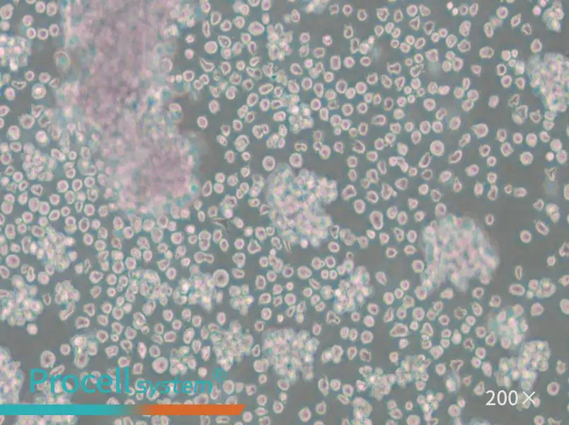 Granta-519 Cell Complete Medium - 4