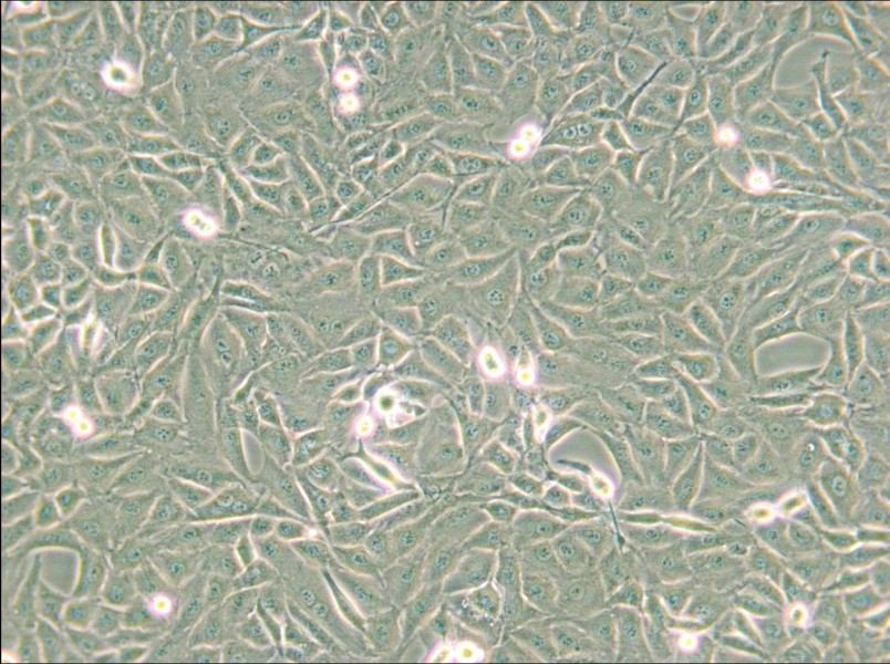 9L/lacZ Cell Complete Medium - 4