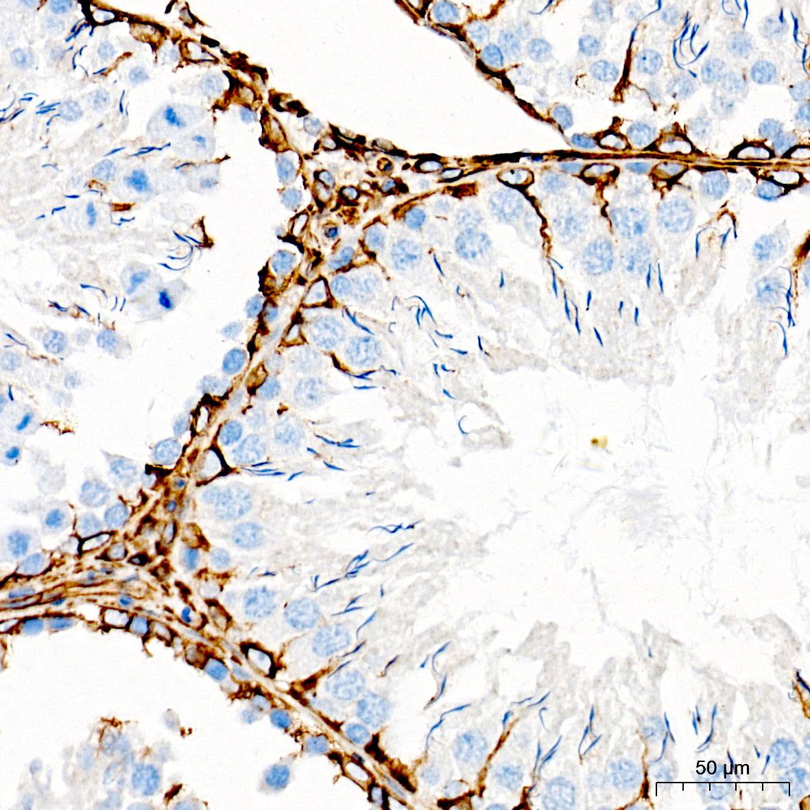 (KO Validated) Vimentin Polyclonal Antibody - small - 8