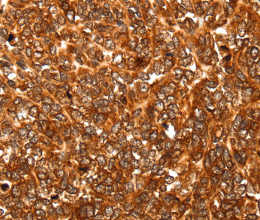 ALDOA Polyclonal Antibody - 2