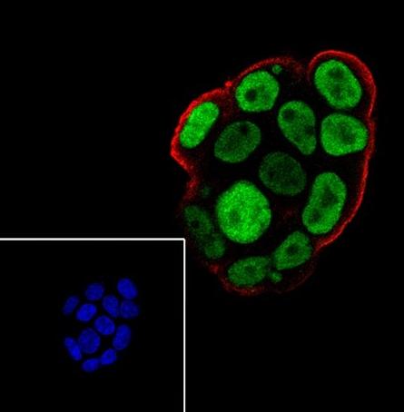 Recombinant AKT1+AKT2+AKT3 Monoclonal Antibody - small - 7