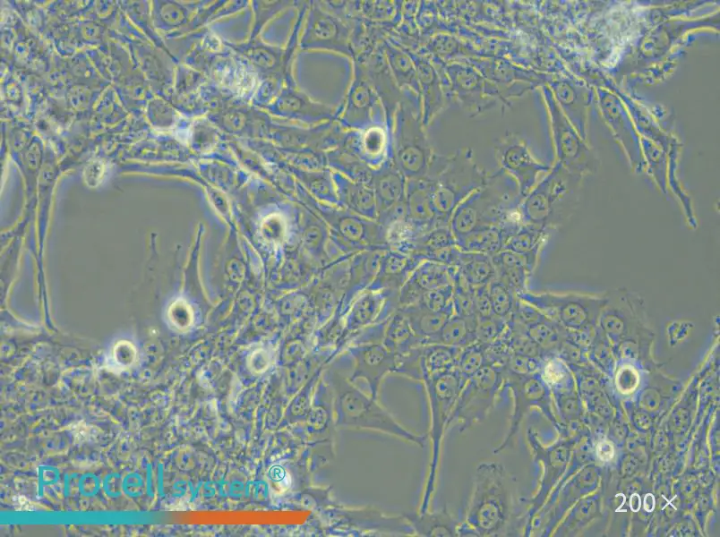 Bewo Cell Complete Medium - small - 4