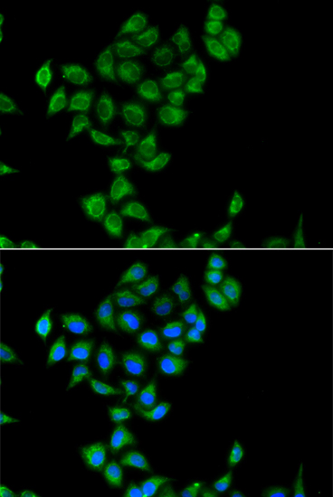 Immunofluorescence analysis of A549 cells using COQ3 Polyclonal Antibody Blue: DAPI for nuclear staining.