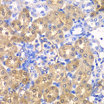 Immunohistochemistry of paraffin-embedded rat kidney using HPD Polyclonal Antibody at dilution of 1:100 (40x lens).Perform microwave antigen retrieval with 10 mM PBS buffer pH 7.2 before commencing with IHC staining protocol.