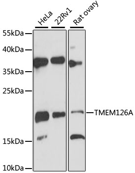 Western blot analysis of extracts of various cell lines using TMEM126A Polyclonal Antibody at 1:3000 dilution.