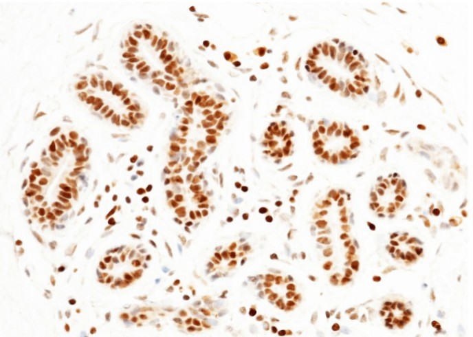 PARP-1/PARP Monoclonal Antibody - small - 3