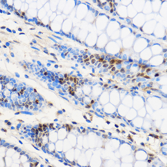 Immunohistochemistry of paraffin-embedded Human colon using ZNF263 Polyclonal Antibody at dilution of 1:100 (40x lens).Perform microwave antigen retrieval with 10 mM PBS buffer pH 7.2 before commencing with IHC staining protocol.