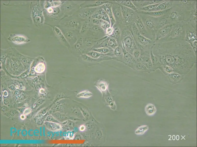 MKN-7 [MKN7; MKN 7] Cell Complete Medium - small - 5