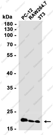 Recombinant UBE2C Monoclonal Antibody - 2