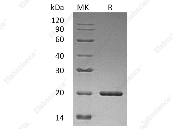 Recombinant Human Sonic Hedgehog/SHH Protein - 1
