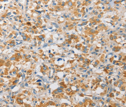 APOBEC3G Polyclonal Antibody - 2
