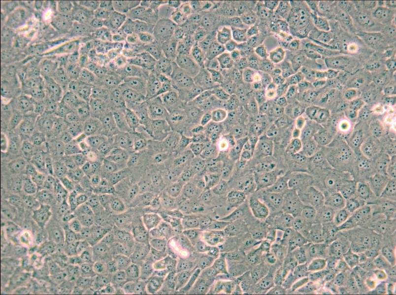 B-CPAP [BC-PAP; BCPAP] Cell Complete Medium - small - 4