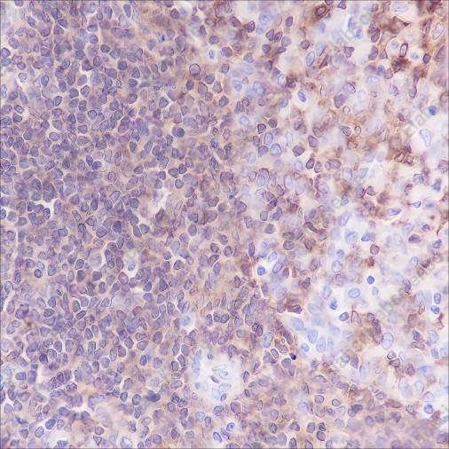 Recombinant CSF-1R Monoclonal Antibody - 2