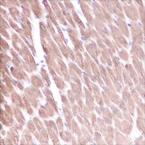 Recombinant Myosin Light Chain 3 Monoclonal Antibody - 5