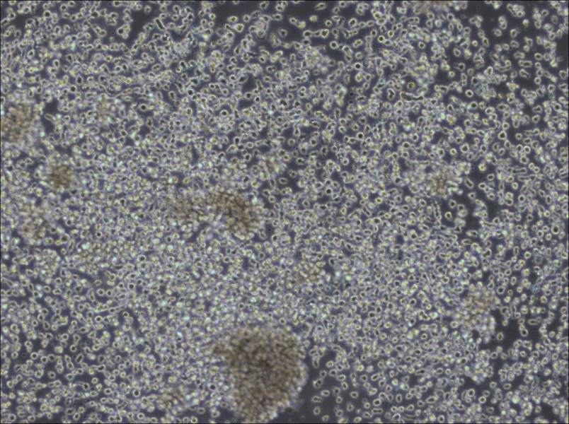 KHYG-1 Cell Complete MediumKHYG-1 Cell Complete Medium - 3