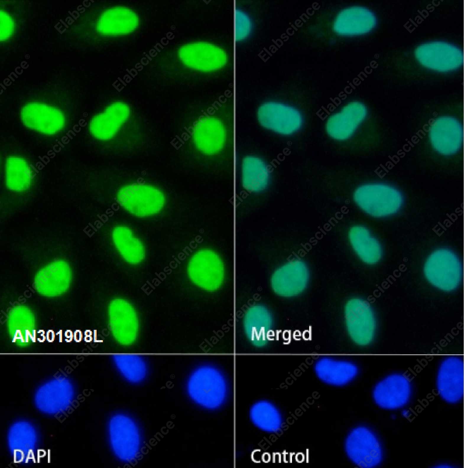 Recombinant SMARCA2/BRM Monoclonal Antibody - 4