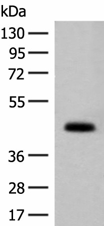 Western blot analysis of Mouse small intestines tissue lysate  using GPA33 Polyclonal Antibody at dilution of 1:200