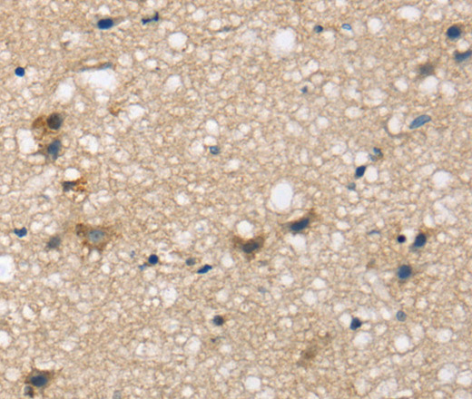 Immunohistochemistry of paraffin-embedded Human brain tissue using SEMA4A Polyclonal Antibody at dilution 1:45