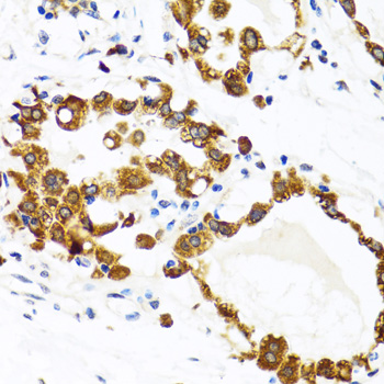 Immunohistochemistry of paraffin-embedded Human breast using HYOU1 Polyclonal Antibody at dilution of 1:100 (40x lens).