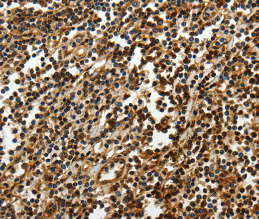 Immunohistochemistry of paraffin-embedded Human tonsil using SOX-13 Polyclonal Antibody at dilution of 1:50