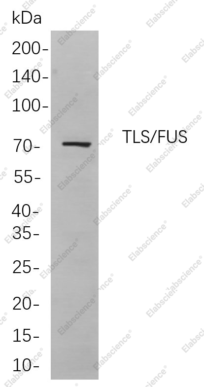 Recombinant TLS/FUS Monoclonal Antibody - 1